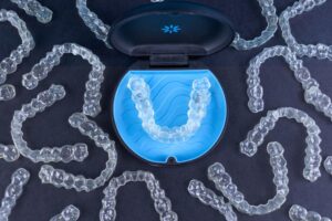 Facts You Need to Know About Invisalign